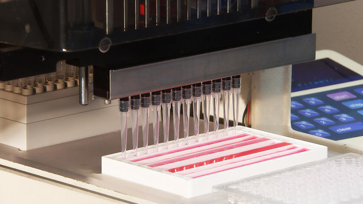 Hunderttausende Tests werden jeden Woche durchgeführt.