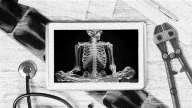 Der Schreibtisch einer Ärztin von oben. Darauf liegt ein Tablet, das ein sitzendes Skelett zeigt. Neben dem Tablett liegt ein Bolzenschneider.