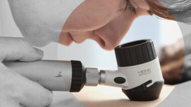 Eine Hautärztin prüft die Haut einer Person mit dem Dermatoskop